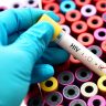 Persisten los diagnósticos tardíos de VIH en España, pese al descenso de nuevos casos
